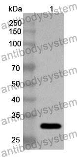 Anti-CHRNA1 Polyclonal Antibody