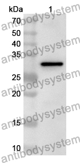 Anti-CHRNA1 Polyclonal Antibody