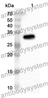 Anti-CD233/SLC4A1 Polyclonal Antibody