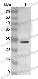 Anti-CD233/SLC4A1 Polyclonal Antibody