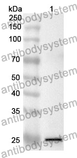 Anti-CRP Polyclonal Antibody