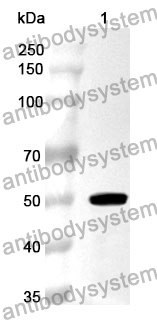 Anti-APCS Polyclonal Antibody