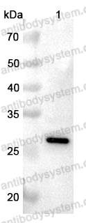 Anti-C1QA Polyclonal Antibody