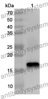 Anti-C1QC Polyclonal Antibody