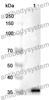 Anti-FN1 Polyclonal Antibody