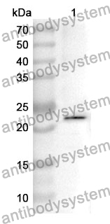 Anti-RBP4 Polyclonal Antibody