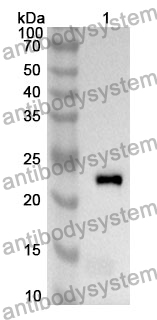 Anti-AMBP Polyclonal Antibody