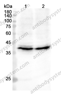 Anti-ORM1/a1AGP Polyclonal Antibody