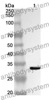 Anti-AHSG Polyclonal Antibody