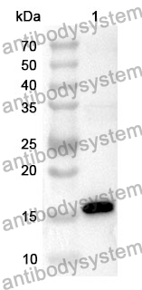 Anti-TTR Polyclonal Antibody