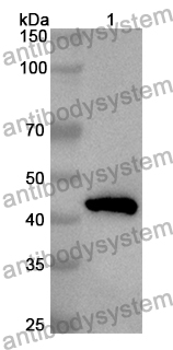 Anti-Human DBP/GC Polyclonal Antibody