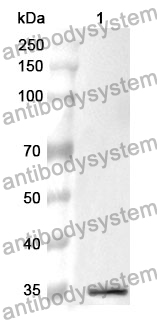 Anti-PF4/CXCL4 Polyclonal Antibody