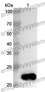 Anti-Human CXCL10/IP-10 Polyclonal Antibody