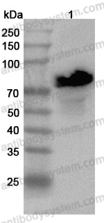 Anti-Human TF/Transferrin Polyclonal Antibody