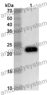 Anti-FTH1 Polyclonal Antibody