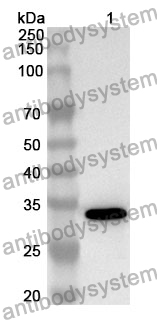 Anti-MT2A Polyclonal Antibody