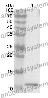 Anti-Osteocalcin/BGLAP/OC Polyclonal Antibody