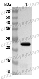 Anti-ESR1/ER-alpha Polyclonal Antibody