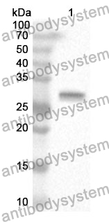 Anti-F11 Polyclonal Antibody