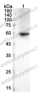 Anti-MMP1 Polyclonal Antibody