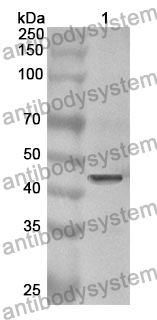 Anti-VTN Polyclonal Antibody