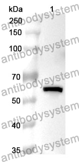 Anti-HMGCR Polyclonal Antibody