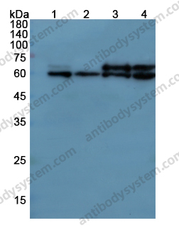 Anti-CAT Polyclonal Antibody