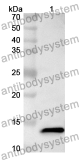 Anti-GBA Polyclonal Antibody