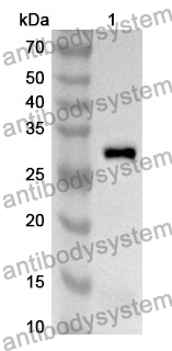 Anti-FUCA1 Polyclonal Antibody