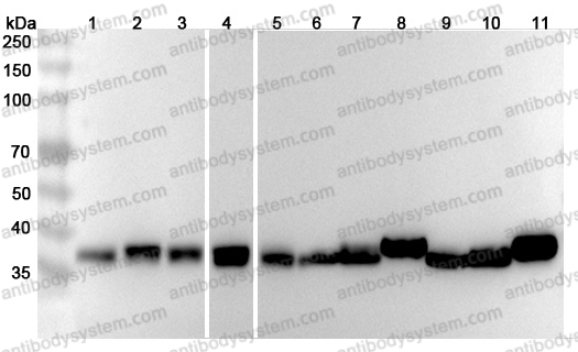 Anti-ALDOA Polyclonal Antibody