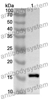 Anti-PDGFA Polyclonal Antibody