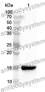 Anti-CSF2/GM-CSF Polyclonal Antibody