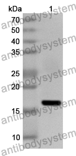 Anti-Human CSF2/GM-CSF Polyclonal Antibody