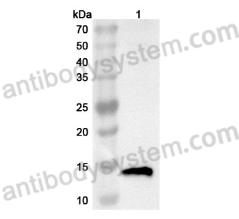 Anti-TFF1 Polyclonal Antibody