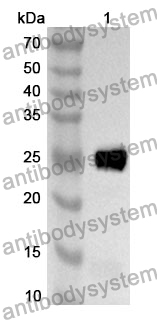 Anti-CD230/PRNP Polyclonal Antibody