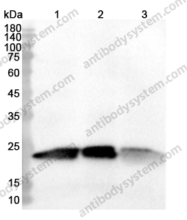 Anti-SOD2 Polyclonal Antibody