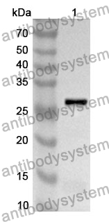 Anti-TK1 Polyclonal Antibody