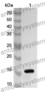 Anti-Human KRT1 Polyclonal Antibody