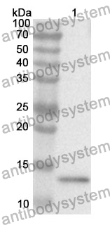 Anti-S100B Polyclonal Antibody