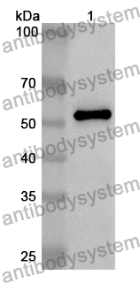 Anti-Human SEMG1 Polyclonal Antibody