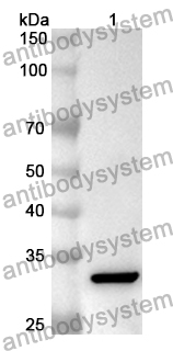 Anti-Human SEMG1 Polyclonal Antibody