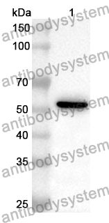 Anti-Human ASL Polyclonal Antibody