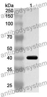 Anti-CD340/ERBB2/HER2/NEU Polyclonal Antibody