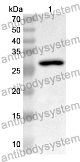 Anti-Human WNT1 Polyclonal Antibody