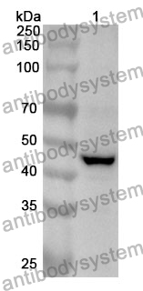 Anti-TP53/p53 Polyclonal Antibody