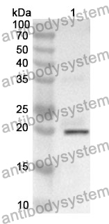 Anti-RPN1 Polyclonal Antibody