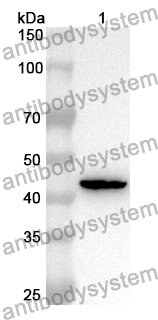 Anti-Human CHGB Polyclonal Antibody