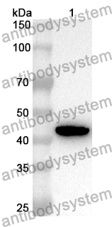 Anti-ALDOB Polyclonal Antibody