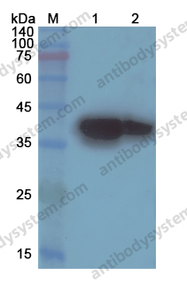 Anti-ARG1 Polyclonal Antibody