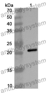 Anti-APOD Polyclonal Antibody